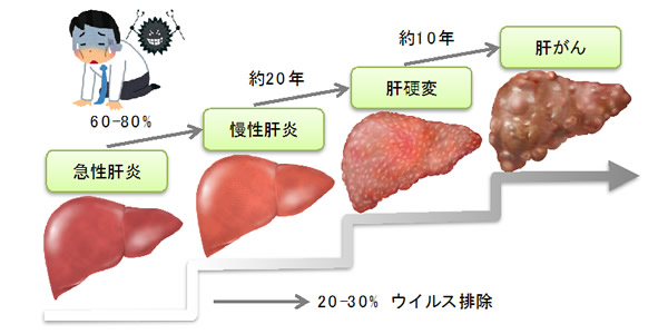 にんにく 肝臓 に 悪い